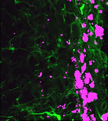 In Pursuit of Stem Cells