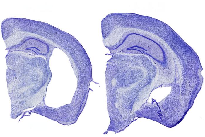 Tauopathy mouse brains