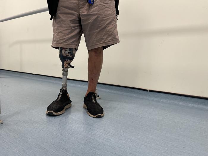 Full prosthetic limb being worn by participant.
