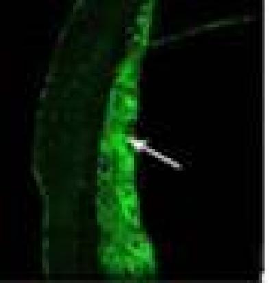 Calpain 1
