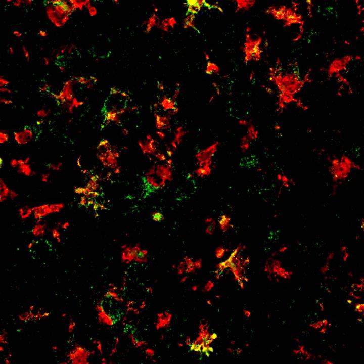 The NLRP3 Inflammasome