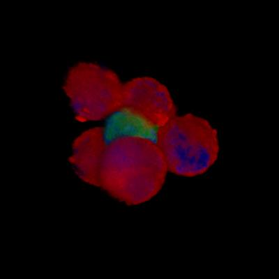 Microtissue