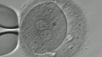 Microinjection of CRISPR/Cas9 into human embryos