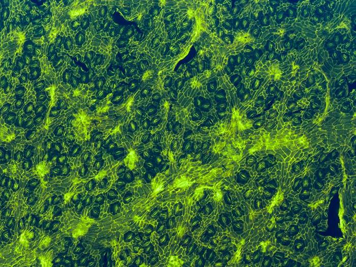 microscope image of fossil leaf