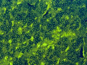 microscope image of fossil leaf