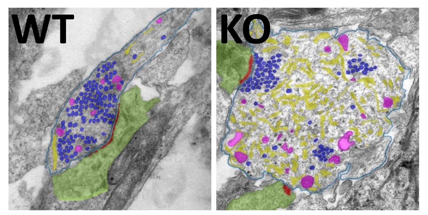 Electron microscopy images of synpses from wildtype (WT) and autophagy-deficient mice (KO)