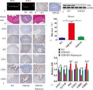 VDR uterine conditional knockout mice showed an endometrial fibrosis phenotype.