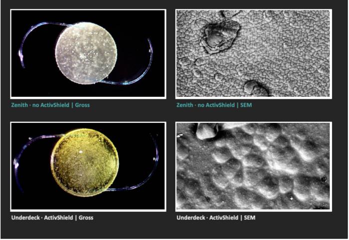Intraocular lenses in space