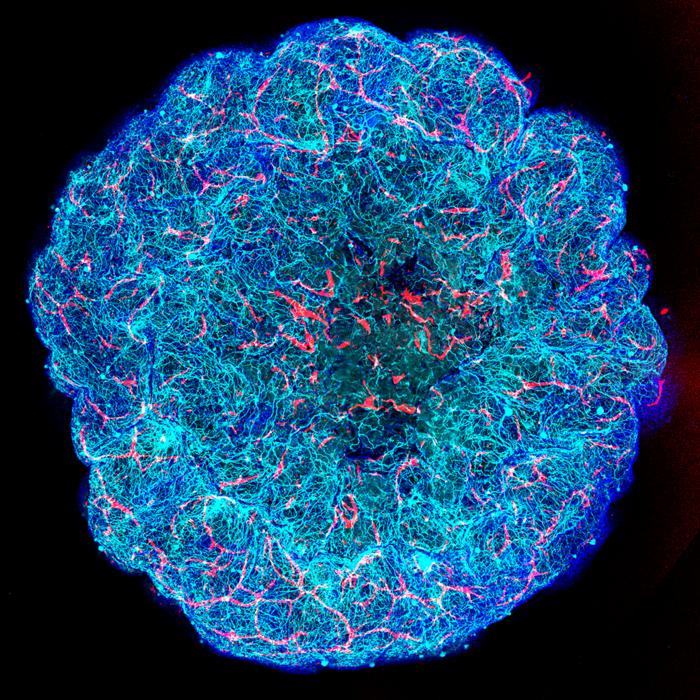 Mount Sinai researchers identify how APOE4 gene damages brain blood ...
