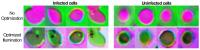 Malaria Smears