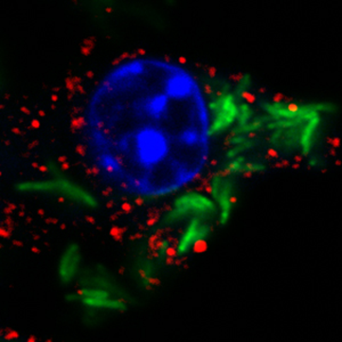MtbGFP TAX1BP1 DAPI merged image