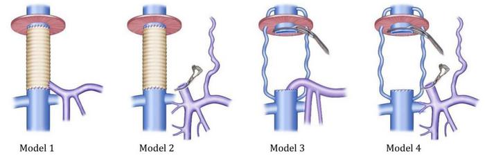 Major approaches of NVVB procedure in ELRA.