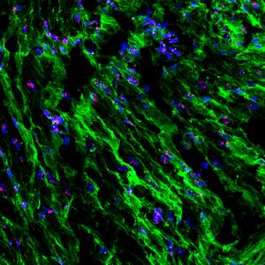 Scripps Research study reveals how uterine contractions are regulated by stretch and pressure during childbirth