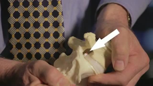 Groundbreaking Study Reveals Best Positions to Save Your Spine During Sex