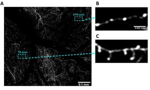 Two-photon microscopy captures axonal segments in a living brain, enabling researchers to quantify structural changes in specialized areas under noninvasive low-intensity repetitive transcranial magnetic stimulation (rTMS).