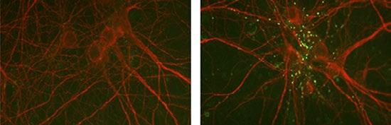 A Collagen XIX Peptide Restores Inhibitory Synapse Formation