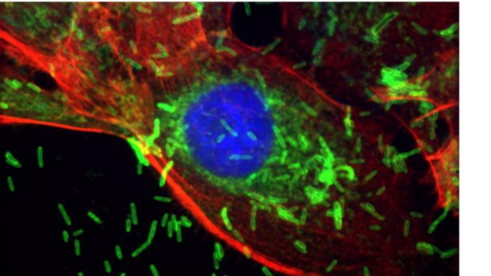 F. nucleatum inside breast epithelial cells