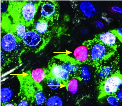 Replicating Human Beta-Cells