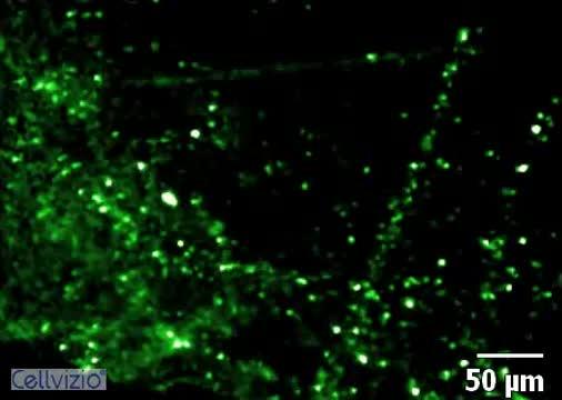 Imaging Platform Captures Hard-to-Track Bacterial Lung Infections in Real Time (1 of 2)