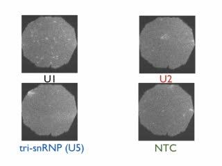 A Window to Spliceosome Assembly (1 of 4)