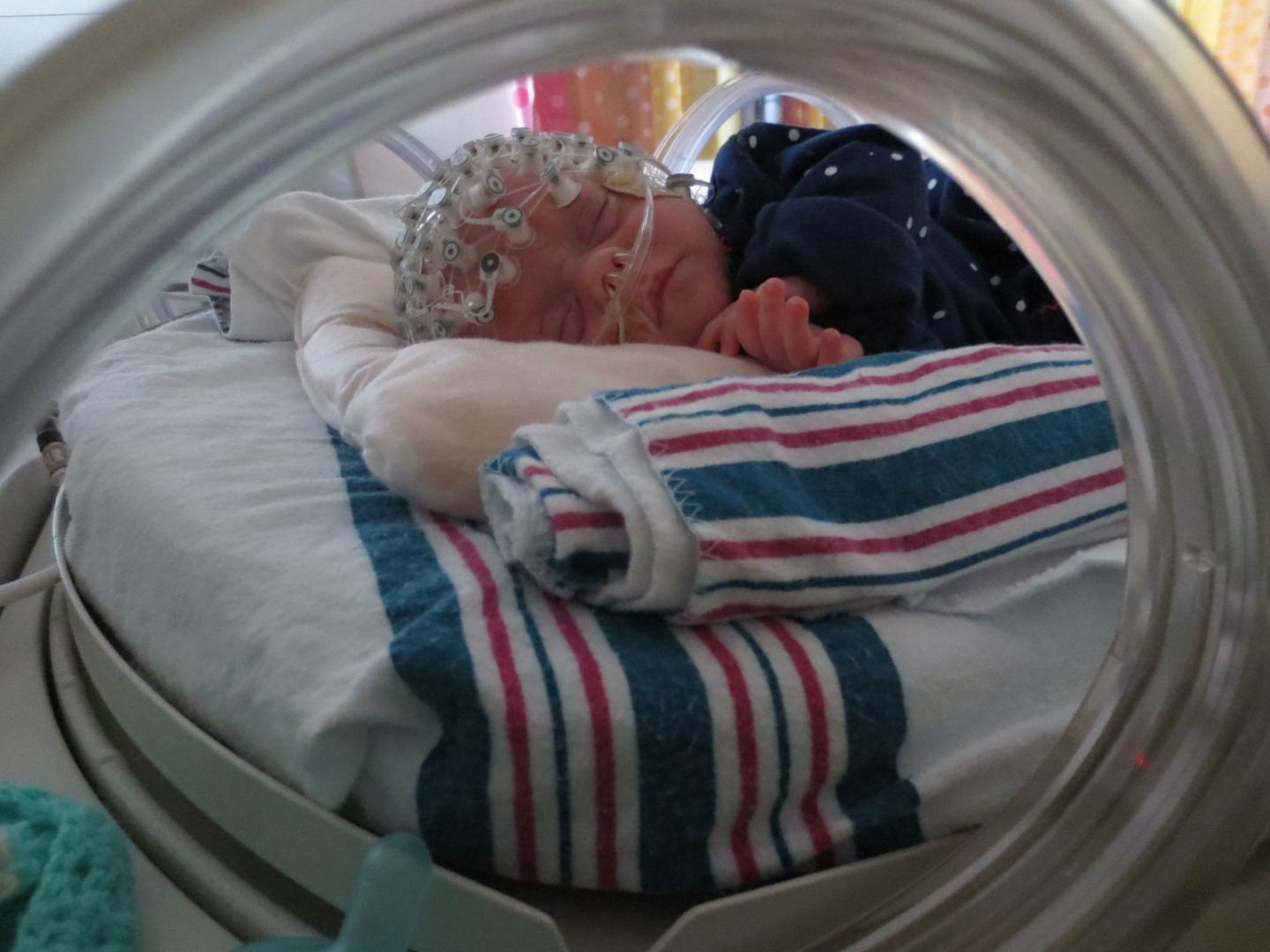 Measuring Preterm Baby Brain Function