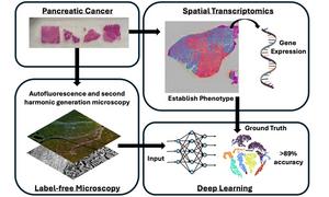 Researchers have developed a new method for pancreatic cancer phenotyping using label-free optical microscopy coupled with a deep learning artificial intelligence algorithm.