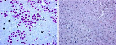 Liver Cells