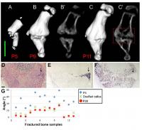 Callus Ossification Progresses after Most of the Realignment Has Occurred