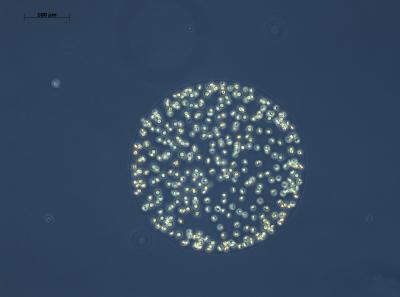 Phaeocystis Colony
