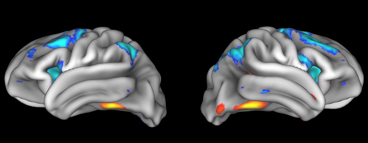 Brain