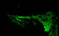 Regenerated Auditory Nerves