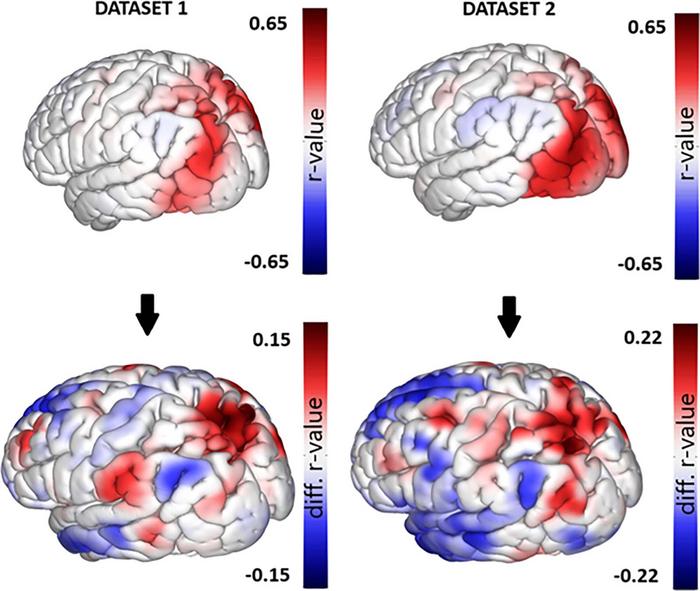 Functional MRI (fMRI) maps obtained from the functional connectivity multivariate patterns analysis