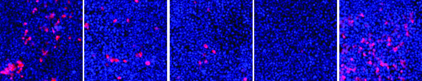 Can a Broadly Potent Antiviral Therapy Take Down SARS and MERS? (1 of 2)