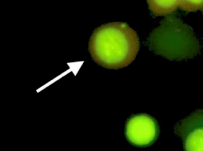 Image of micronucleated HAP1 cells