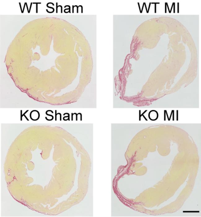 Heart tissue sections