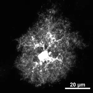 Astrocyte