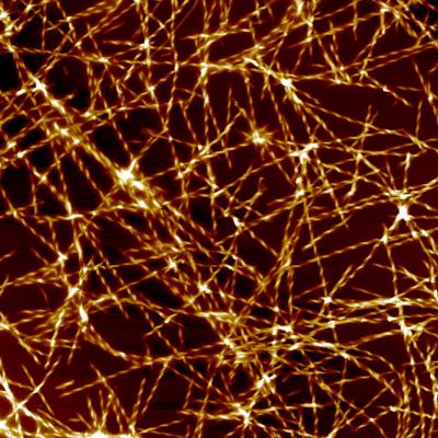 Amyloid Fibril