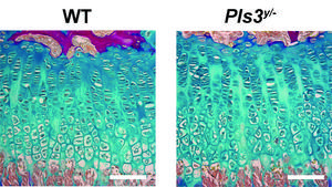 Epiphyseal plate microscopy image