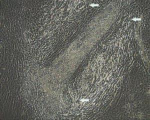 Beating Heart Muscle Cells