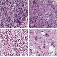 Cell image patches.