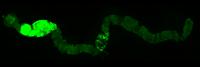 <i>Drosophila</i> Tumor