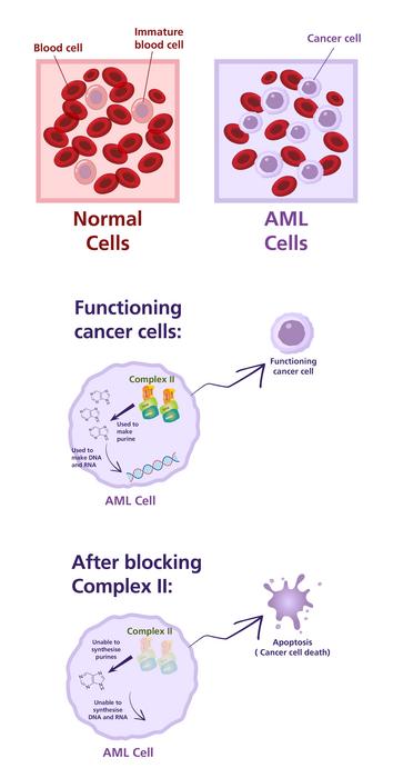 The effect of depriving cancer cells of Complex II
