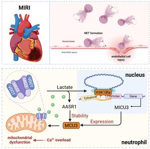 Figure 1：Lactate-Induced MICU3 Aggravates Myocardial Ischemia-Reperfusion Injury by Promoting NETs Formation