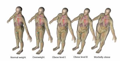 Obese Phantoms