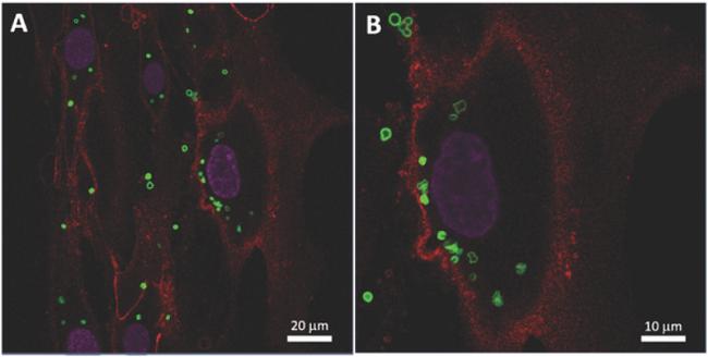 Magnetization of mesenchymal stem cells