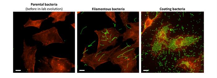 Image 2 – Two distinct patterns of attachment to human cells: Filamentous & Coating