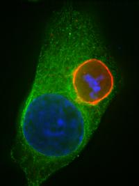 Liver Stage with Actin