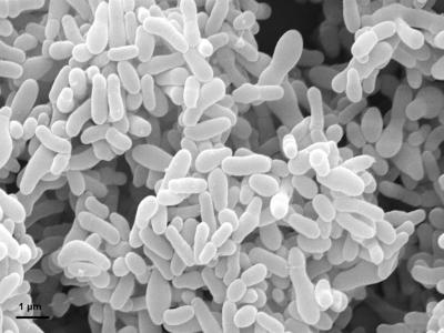 <em>Gardnerella vaginalis</em>
