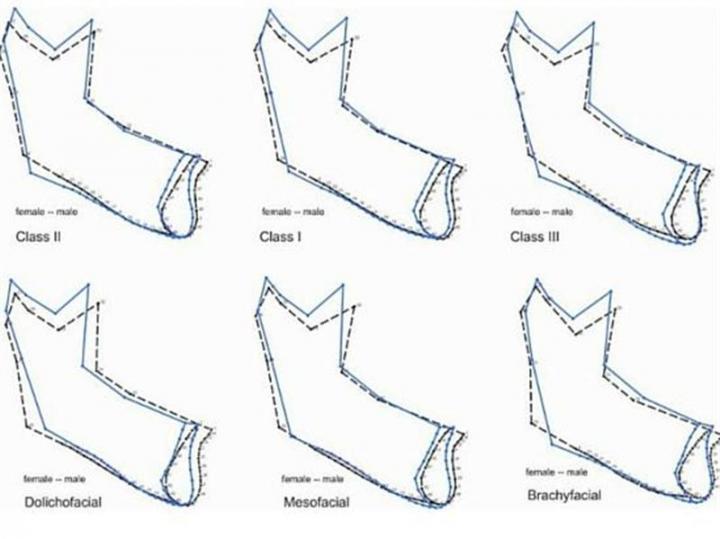 New Data Improve Techniques for Determining Whether a Jaw Bone Comes from a mMan or Woman