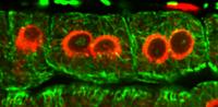Plant Cells with More than One Nucleus